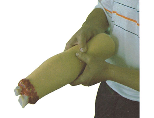 ��֫�����ֹ֫Ѫģ��